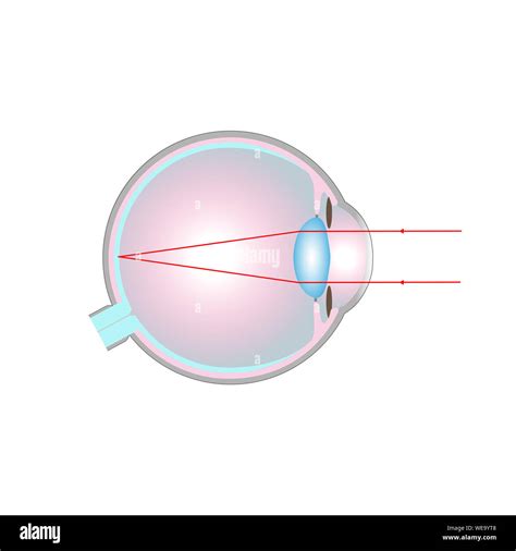 Normal Eye Vision 的图像结果