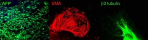 Dr. Shaji R Velayudhan | Centre for Stem Cell Research (CSCR)