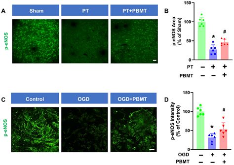 Photobiomodulation Inhibits Ischemia-Induced Brain Endothelial ...