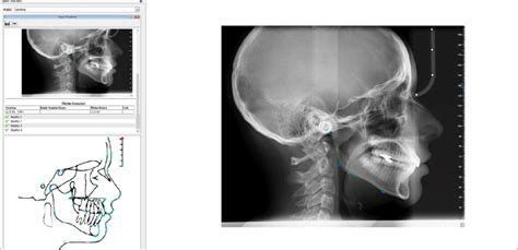Image result for Accessing Dll From Python