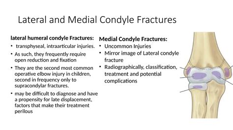 Lateral and Medial Humeral Condyle Fractures.pptx