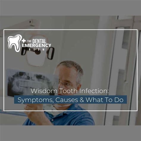 What Are Symptoms Of Wisdom Teeth Infection at Bridget Mireles blog