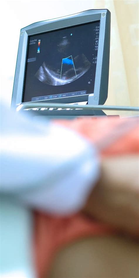 Can I Self Refer for Echocardiogram Scan UK? | Vista Health