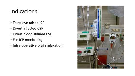 External Ventricular Drain (EVD) | PPTX