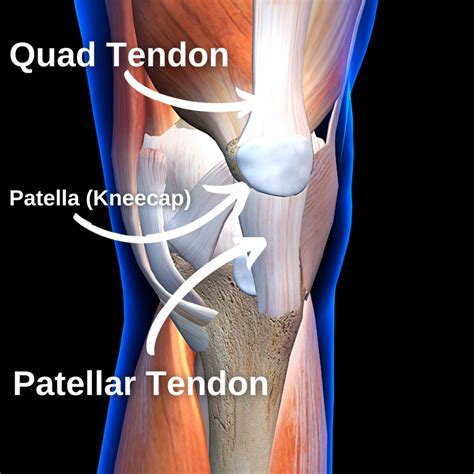Pain In Knee Quadriceps Tendon at Joseph Larrick blog