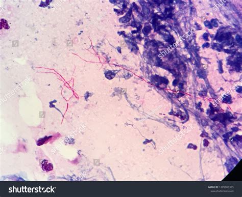 220 Catalase Images, Stock Photos & Vectors | Shutterstock