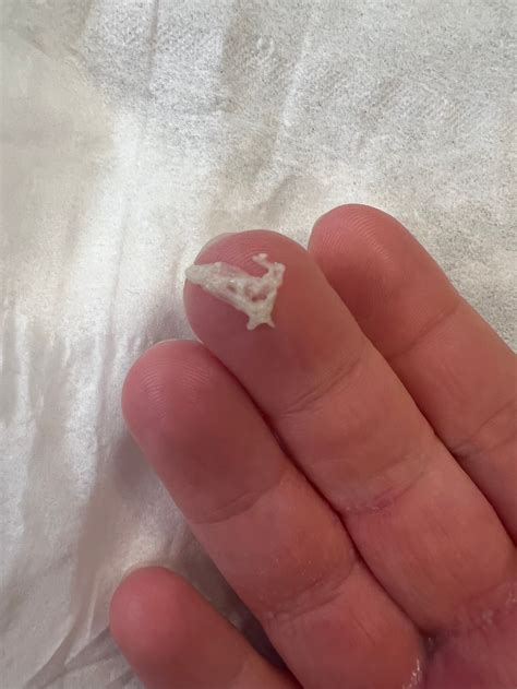 Clumpy Discharge 的图像结果