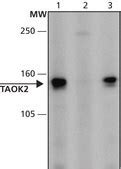 Anti-TAOK2 (976-990) antibody produced in rabbit IgG fraction of ...