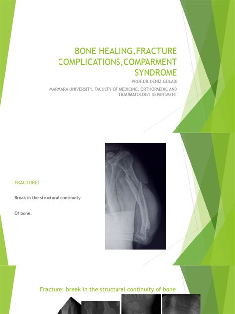 Bone Healing, Complications, Compartment Syndrome | Download Free PDF | Bone | Diseases And ...