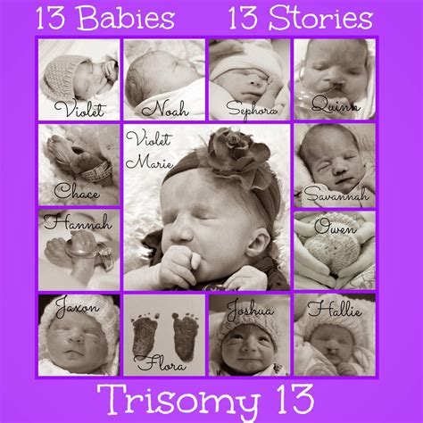 Trisomy 13: 13 Babies, 13 Stories