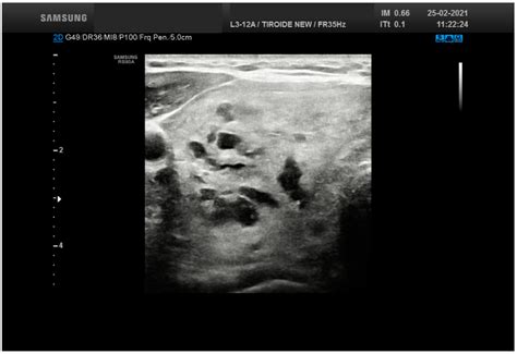 Overview of the Ultrasound Classification Systems in the Field of ...