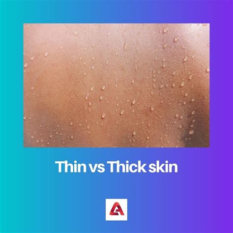 Thin vs Thick Skin: Difference and Comparison