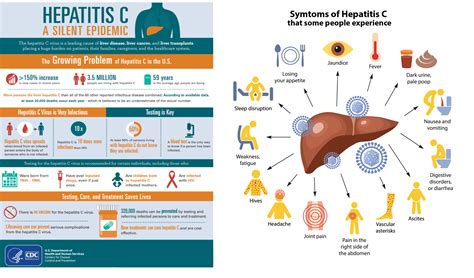 Hepatitis C Symptoms