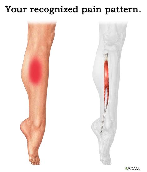 Rebalancing the Peroneus Longus