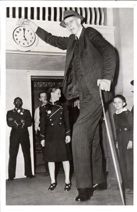 Acromegaly - Gigantism; The World's Tallest Human | HubPages