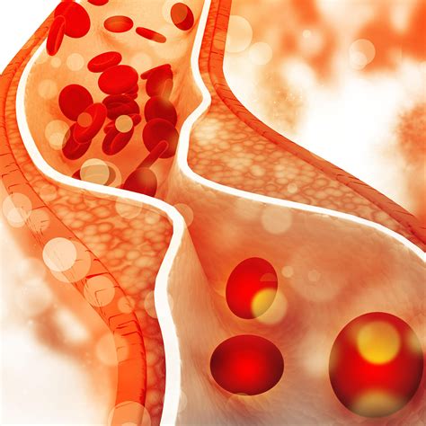 The Top Foods for Optimal Cholesterol Management – Lifezen Healthcare