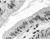Identifying Tissue Types 的图像结果