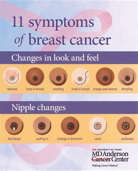 How breast cancer affects women in the US | Lakeisha N. Falwell, MS, NP ...