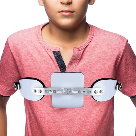 ShuyanJiao Shuyan Jiao Pectus Carinatum Orthosis Brace, Pigeon India | Ubuy