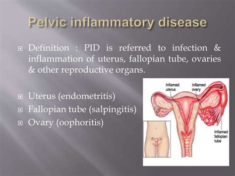 Image result for Female Reproductive System Disorders