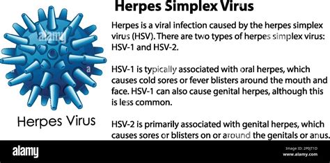 Image result for Simplex Virus 2