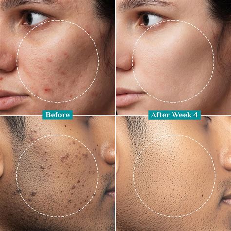 Buy Alpha Arbutin Vitamin C Brightening Serum Online