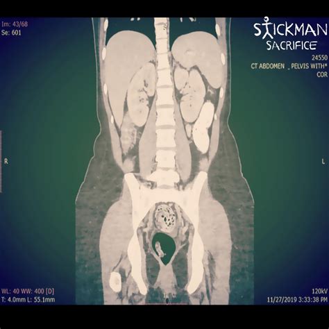 ‎Sacrifice (feat. Lexxi Rae) - Single - Album by Stickman - Apple Music