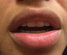 Image result for Lip