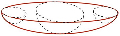 Design Specifications for an Auxiliary Incision Retractor in ...