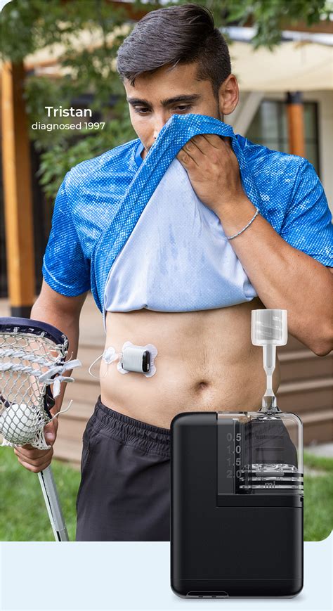Dexcom CGM & t:slim X2 Insulin Pump | Tandem Diabetes Care