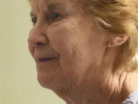 Just retired - Meet Maggie: First person in the world to receive a ...