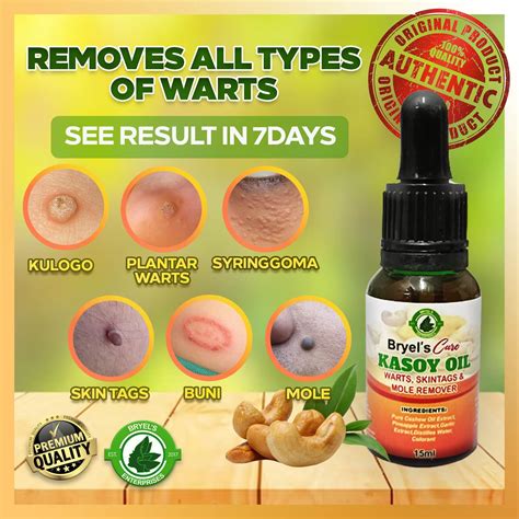 ⚡ ⭐WISH BEAUTY 15ML WART REMOVER Pure Organic Authentic Kasoy Oil Warts Remover, Skin Tags ...