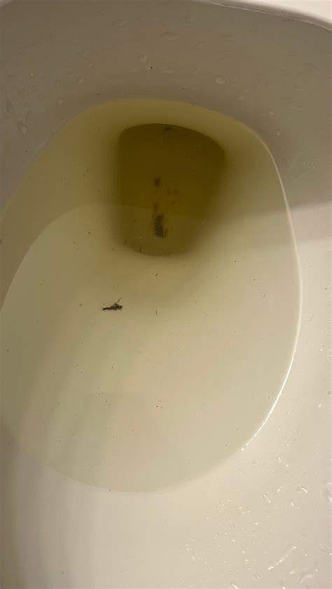 Brown blood clots in urine | BabyCenter