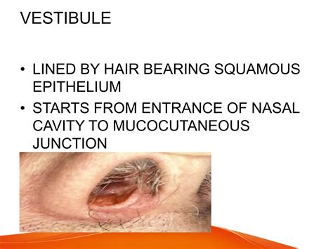 ANATOMY OF NOSE | PDF