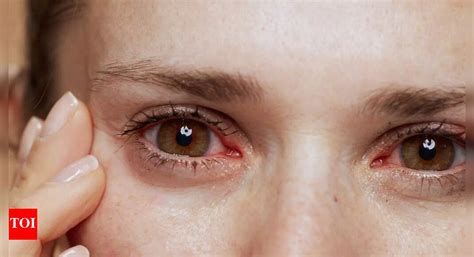 How to protect your eyes from infection this monsoon: 10 effective tips ...