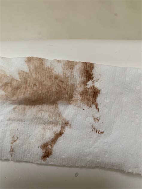 Implantation Bleeding Brown And Pink