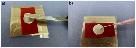 An Injectable Glass Polyalkenoate Cement Engineered for Fracture ...
