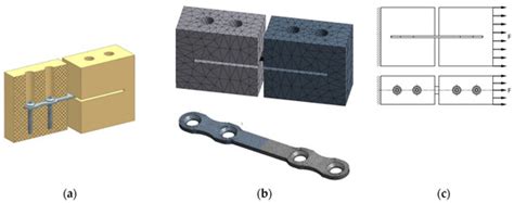 Strength of Products Made of Ultrafine-Grained Titanium for Bone ...