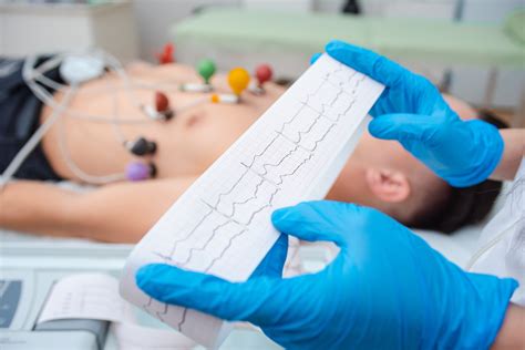 What is an EKG? Benefits, Procedure & Who Should Get Tested