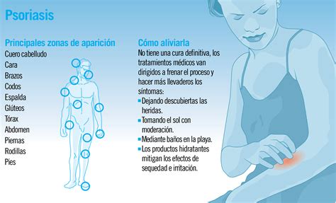 ¡Cómo curar la psoriasis en 3 meses o menos! PARTE 2 ~ Psoriasis