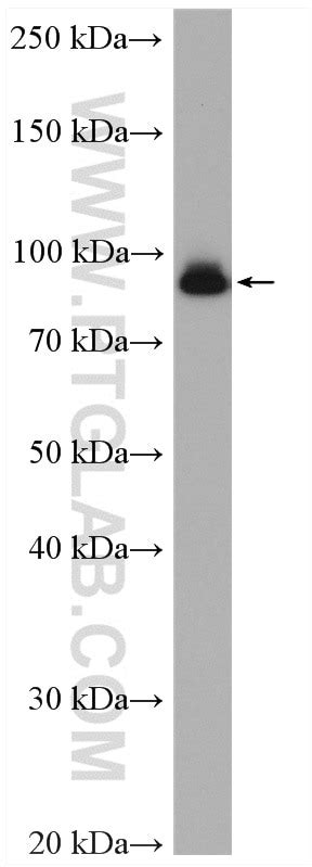 Beta Catenin antibody (17565-1-AP) | Proteintech