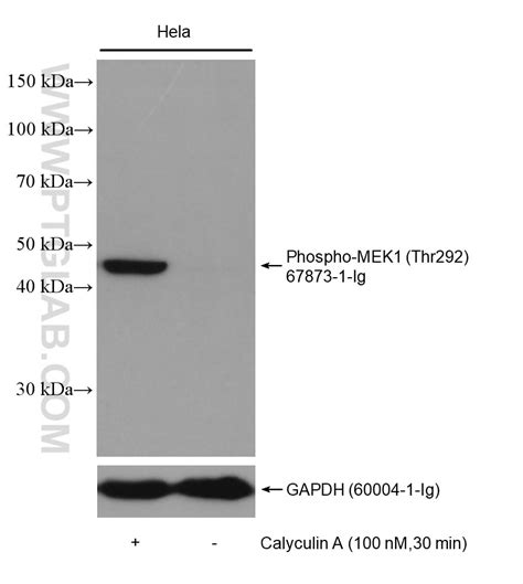 Phospho-MEK1 (Thr292) antibody (67873-1-Ig) | Proteintech