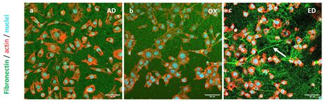 Fibronectin Conformations after Electrodeposition onto 316L Stainless ...