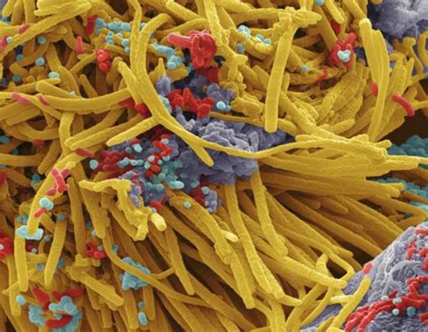Las reveladoras imágenes de las bacterias que viven en nuestra boca ...