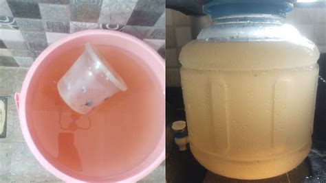 Pune: Water Contamination Near Khadakwasla Well Led To Guillain-Barré ...