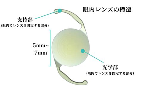 Image result for Appendix Instrument Example
