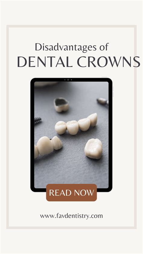 Disadvantages Of Dental Crowns: Top 5 Risks To Know - disadvantages of dental crowns