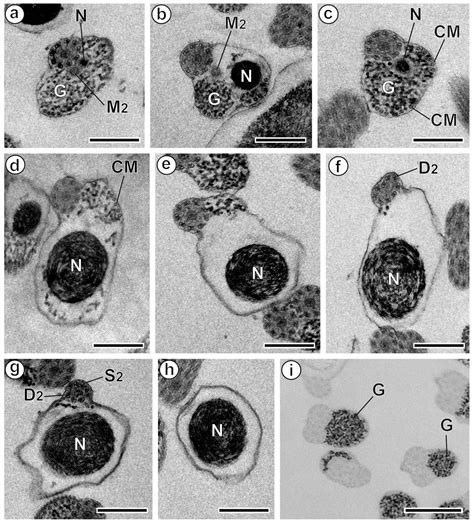 Ultrastructural Characteristics of the Mature Spermatozoon of ...