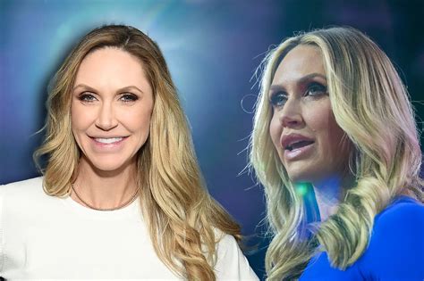 Lara Trump Before And After Cosmetic Surgery: A Makeover
