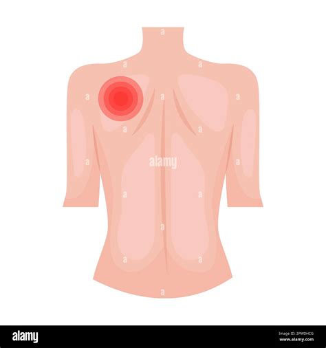 Sharp Pain Under Left Breast And Shoulder Blade at Brodie Parkhill blog